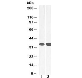 Western blot testing of human 1) heart and 2) liver lysate with MDH2 antibody at 0.03ug/ml. Predicte