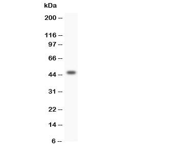 Western blot testing of human SW620 cell lysate with HOXA3 antibody. Predicted molecular weight ~46 