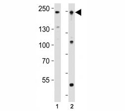 Western blot analysis of lysate from human K562 and mouse F9 cell line using Dnmt1 antibody at 1:100
