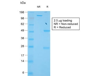 SDS-PAGE analysis of purified, BSA-free recombinant TIMP1 antibody (clone TIMP1/1944) as confirmatio