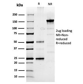 SDS-PAGE analysis of purified, BSA-free Prolactin antibody (clone PRL/2910) as confirmation of integ