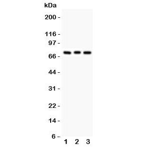 PKC beta 1 Antibody