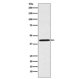 Western blot testing of human HeLa cell lysate with Sprouty 2 antibody. Expected molecular weight: 3