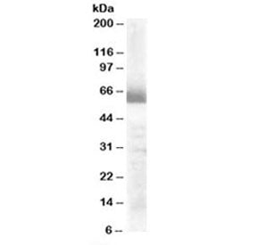 Western blot testing of human ovay lysate with CYP17A1 antibody at 0.3ug/ml. Predicted molecular wei