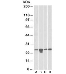 Western blot testing of A) HeLa, B) HepG2, C) HEK293 and D) mouse NIH3T3 lysate with SOD2 antibody a