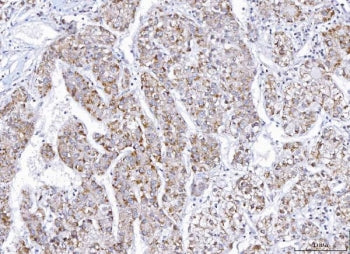 E2F3 Antibody