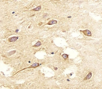 IHC testing of FFPE human brain tissue with NOS2 antibody. HIER: steam section in pH6 citrate buffer