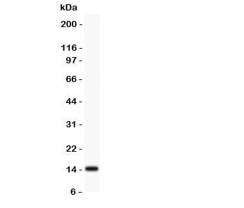 Profilin 2 Antibody