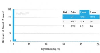 Analysis of a HuProt(TM) microarray containing more than 19,000 full-length human proteins using LTF