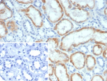 Mineralocorticoid Receptor Antibody / MR / NR3C2