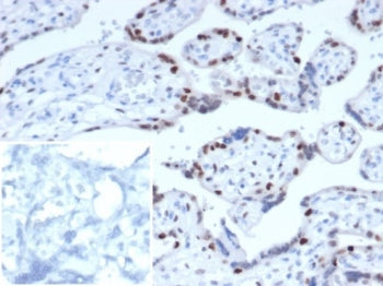IHC staining of FFPE human placental tissue. Strong nuclear staining observed using KIP2/7187 at 2ug