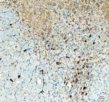 Immunohistochemical staining of TPH2 using anti-TPH2 antibody. TPH2 was detected in a paraffin-embed