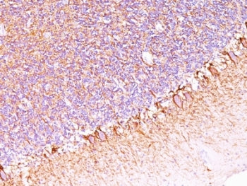 IHC: Formalin-fixed, paraffin-embedded human cerebellum stained with anti-Neurofilament antibody (SP