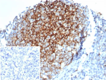 CD23 Antibody