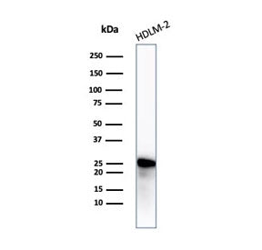 Bcl-2 Antibody
