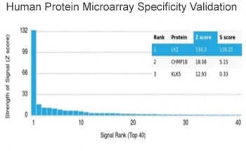 Analysis of HuProt(TM) microarray containing more than 19,000 full-length human proteins using Lysoz