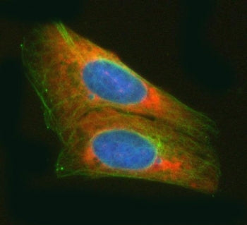 ArgRS Antibody / RARS1 / Arginyl-tRNA synthetase