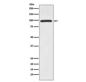 Western blot testing of human Jurkat cell lysate with HMGCR antibody. Predicted molecular weight ~97