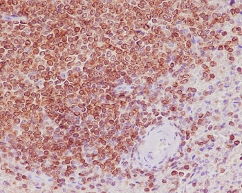 IHC staining of FFPE human spleen tissue with Bcl-2 antibody. HIER: boil tissue sections in pH6, 10m