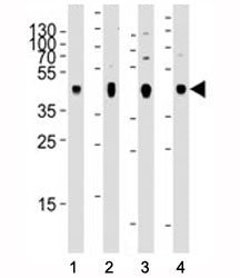 PDK2 Antibody / Pyruvate dehydrogenase kinase 2, 0.08ml