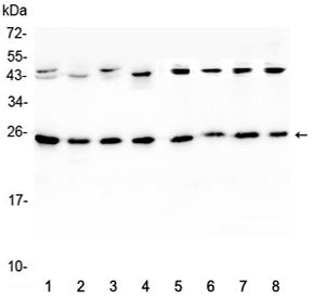 Western blot testing of 1) rat brain, 2) rat lung, 3) mouse brain, 4) mouse lung and human 5) HeLa, 