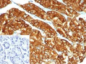 IHC staining of FFPE human stomach tissue with Claudin18.2 antibody (clone CLDN18.2/8014R). Inset: P