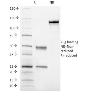 CD41 Antibody / ITGA2B