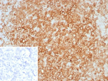 IHC staining of FFPE human tonsil tissue with HLA-DR antibody (clone rHLA-DRA/8285). Inset: PBS used