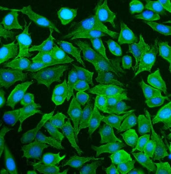 Immunofluorescent staining of FFPE human HeLa cells with NEAS antibody (green) and DAPI nuclear stai