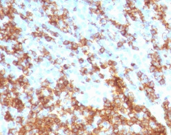 IHC staining of FFPE human tonsil tissue with recombinant CD45RB antibody (clone CDLA45RB-2R). Requi