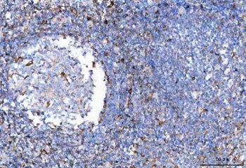 IHC staining of FFPE human tonsil tissue with TRAC antibody. HIER: boil tissue sections in pH8 EDTA 