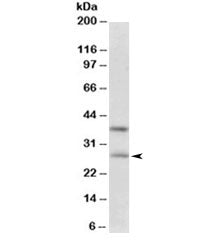Western blot testing of human hippocampus lysate with FGF23 antibody at 0.3ug/ml. Predicted molecula