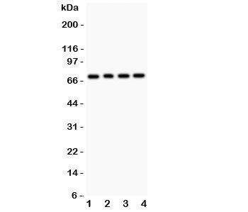 Western blot testing of FOXO1 antibody and Lane 1: rat lung; 2: (r) brain; 3: human COLO320; 4: (h) 