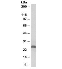 Western blot testing of human liver lysate with Apolipoprotein D antibody at 0.3ug/ml. Predicted mol