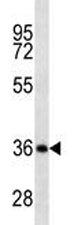 CD20 Antibody