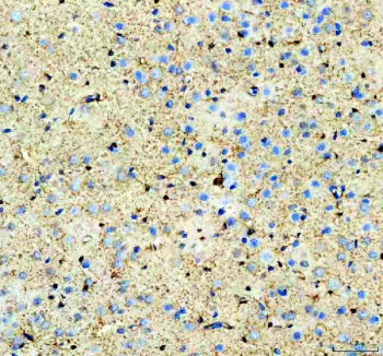 Immunohistochemical staining of Aldolase C/ALDOC using anti-ALDOC antibody. Aldolase C/ALDOC was det