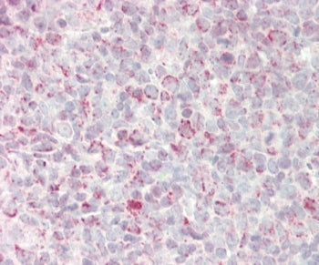 IHC testing of FFPE human tonsil tissue with GADD45A antibody. HIER: steam section in pH6 citrate bu