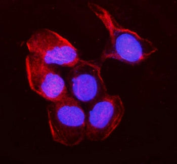 Immunofluorescent staining of FFPE human A431 cells with MYH10 antibody (red) and DAPI nuclear stain
