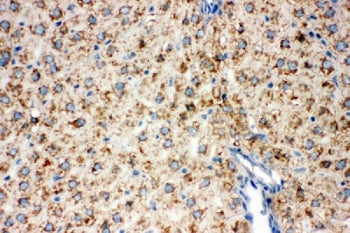 IHC staining of FFPE rat liver tissue with Lipoamide Dehydrogenase antibody. HIER: boil tissue secti