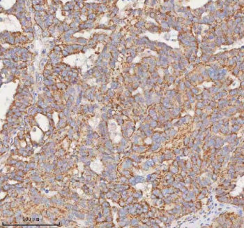 Immunohistochemical staining of SLC7A7 using anti-SLC7A7 antibody. SLC7A7 was detected in a paraffin