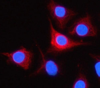 PRSS44 Antibody / TESSP-4