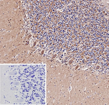 IHC staining of FFPE human brain tissue with recombinant Amyloid beta antibody (clone APP/9971R). In