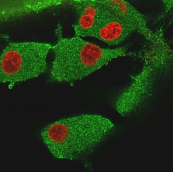 Immunofluorescent staining of PFA-fixed human U-87 MG cells with Vinculin antibody (clone VCL/3617, 
