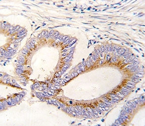 GDF11 Antibody