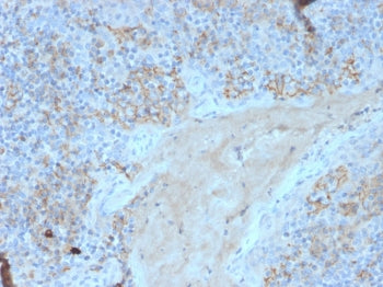 IHC staining of FFPE human tonsil with CD95 antibody. HIER: boil tissue sections in pH 9 10mM Tris w