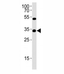 OTX2 Antibody