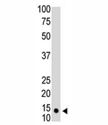 The SUMO1 antibody used in western blot to detect SUMO1 in HL-60 cell lysate. Predicted molecular we