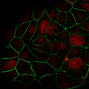 Immunofluorescent staining of human MCF7 cells with recombinant E-Cadherin antibody (green, clone rC