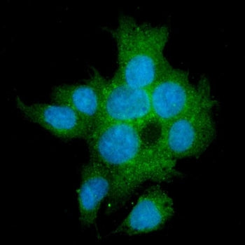 Immunofluorescent staining of FFPE human HepG2 cells with TGF beta Receptor II antibody (green) and 