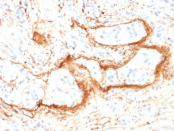 IHC testing of FFPE human small intestine with Elastin antibody (clone ELN/1981). Required HIER: boi